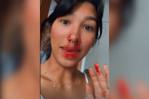 Imagem colorida de uma jovem com rosto machucado - Metrópoles