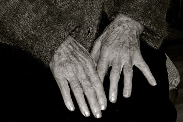 Mãos de mulher idosa sobre as pernas