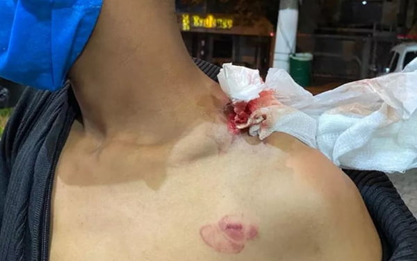 PMs disparam balas de borracha na boca e ombro de ambulantes em São Paulo, no ano passado