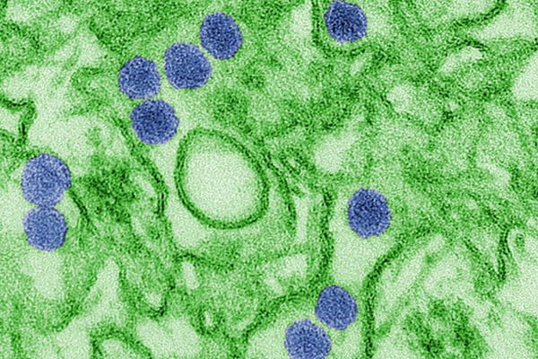 zika vírus visto por microscópio