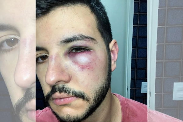 Matheus Ribeiro vítima de assalto