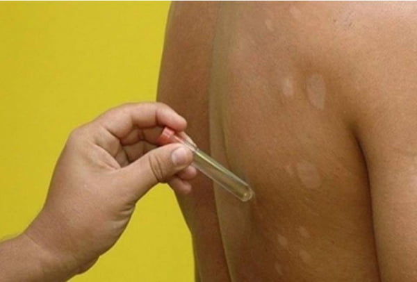 Medico analisa amostras coletadas na pele de paciente - Metrópoles