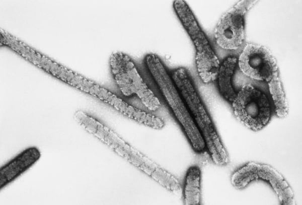 Fotografia em preto e branco do vírus marburg visto por lente de microscópio - Metrópoles