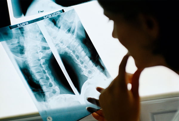 Foto mostra médica estudando exame de raio-X