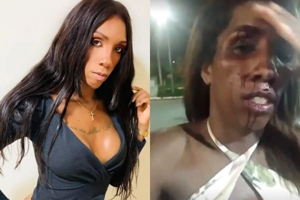 Colagem de fotos de transexual antes e depois de agressão