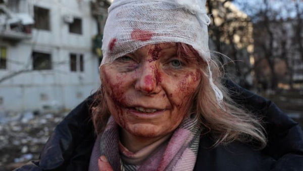 Mulher ucraniana com rosto ensanguentado e enfaixado após ataque russo olha para a câmera - Metrópoles