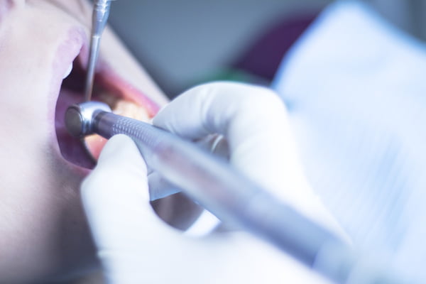 Dentista examinando boca de paciente. Imagem ilustrativa contenção dentes
