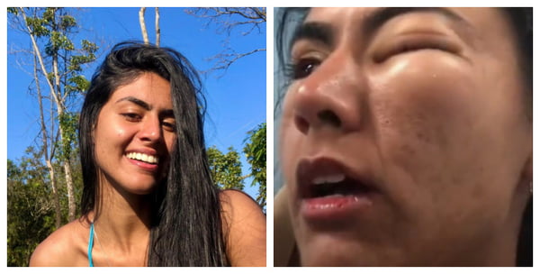 Amanda Nicândio antes e depois