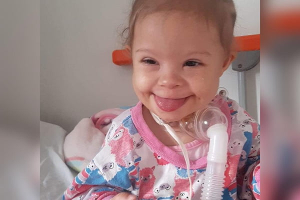 Ana Vitória, bebê com sindrome de Down - Metrópoles