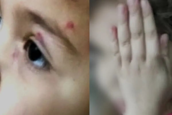 Montagem com fotos de criança agredida no Paraná - Metrópoles