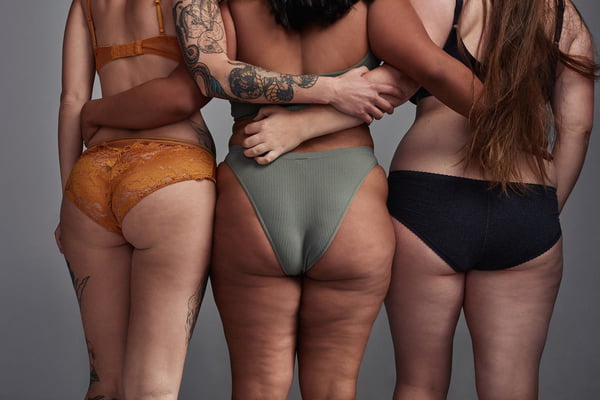 Fotografia de três mulheres de costas, de calcinha, mostrando a celulite nas pernas - Metrópoles