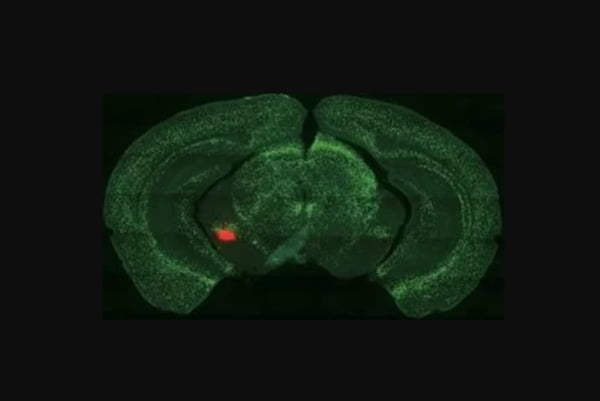 Imagem mostra amígdalas cerebrais ativadas (em vermelho) dentro do cérebro de ratos viciados em açúcar - Metrópoles