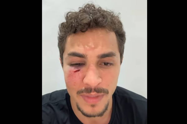 Imagem mostra secretário de juventude que foi agredido durante assalto no Rio de Janeiro - Metrópoles