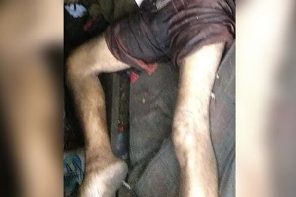 Imagem mostra pernas de homem que teria morrido de frio em zona de fronteira - Metrópoles