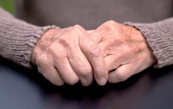 Imagem colorida de mãos de pessoa idosa - Metrópoles