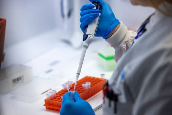imagem colorida mostra pessoa com luvas manuseando equipamentos para fazer testes de laboratório