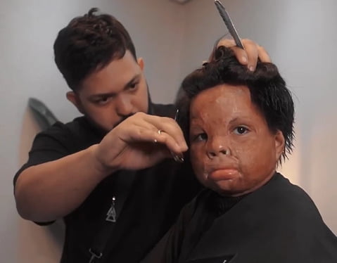 Homem branco corta cabelo de menino negro; o rosto da criança possui cicatrizes de queimaduras - Metrópoles
