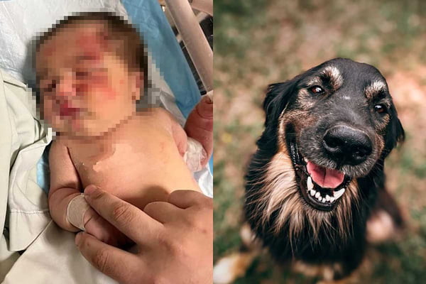 imagem de bebê machucado ao lado de cachorro em montagem de foto