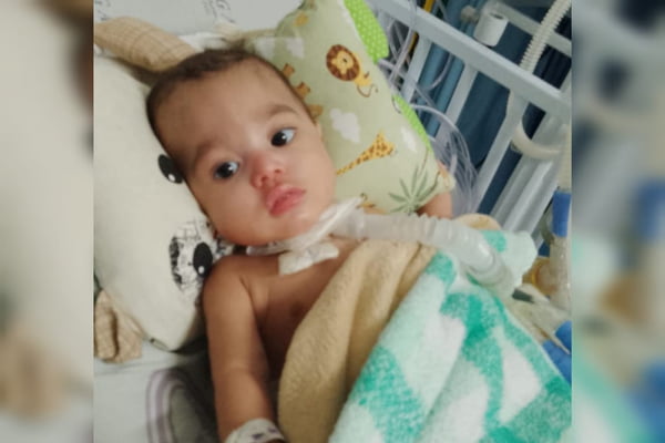 Foto mostra close-up em rosto de bebê que está acamado com uma traqueostomia - Metrópoles