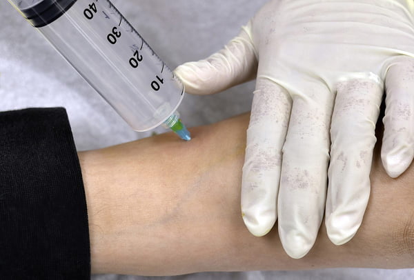 Imagem mostra mão com luva aplicando injeção no tornozelo de uma pessoa. A seringa está cheia de ar - Metrópoles