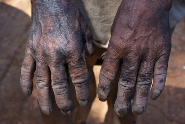 foto colorida de referência sobre trabalho escravo mostra duas mãos negras lado a lado sujas e deterioradas pelo trabalho físico - Metrópoles
