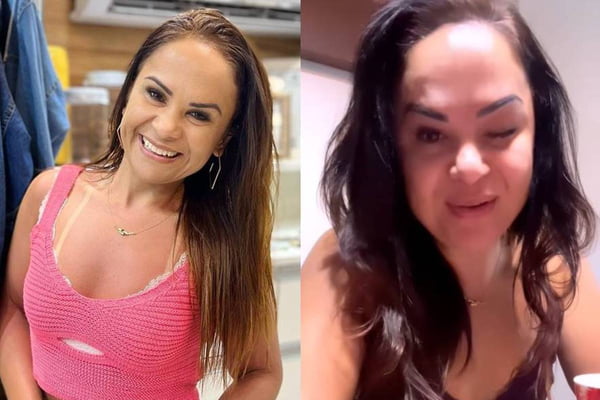 Montagem com duas fotos coloridas da empresária brasileira que ficou com o olho paralisado após uma aplicação de botox - Metrópoles