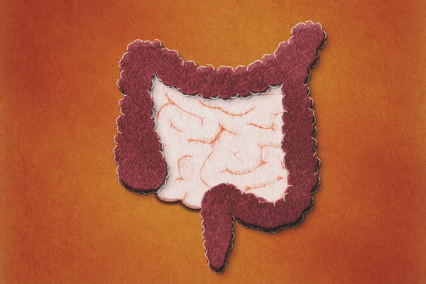 Imagem mostra uma representação de intestino feito de feltro - Metrópoles