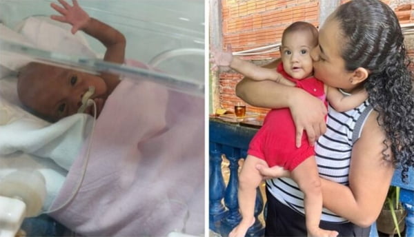Imagem da bebê Thuany Almeida, recuperada após parto prematuro - Metrópoles