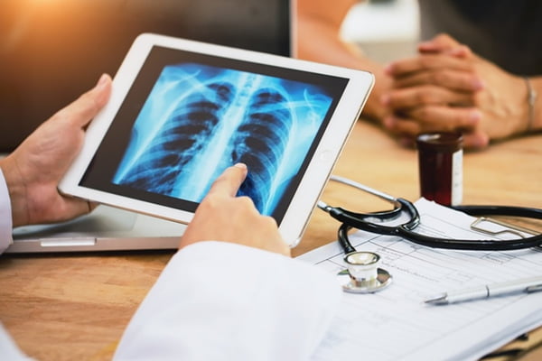 Médico segura tablet para mostrar câncer no pulmão - Metrópoles