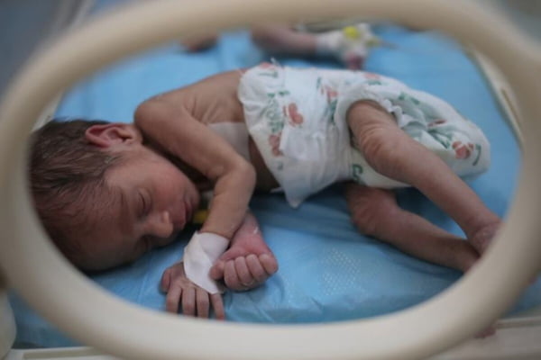 Imagem colorida de um recém-nascido em incubadora - Metrópoles