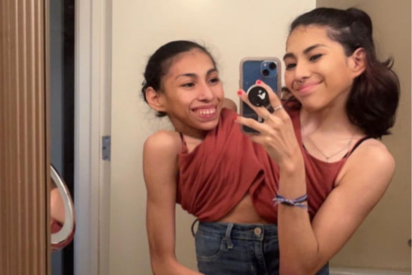 Gêmeas siamesas compartilham rotina e detalham vida íntima em vídeo