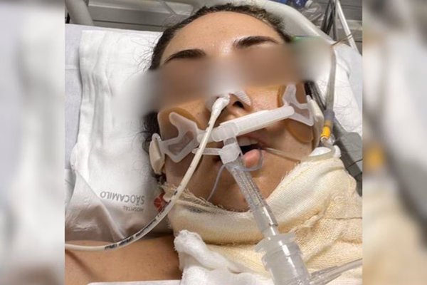 Imagem colorida de mulher hospitalizada após tentativa de feminicídio - Metrópoles