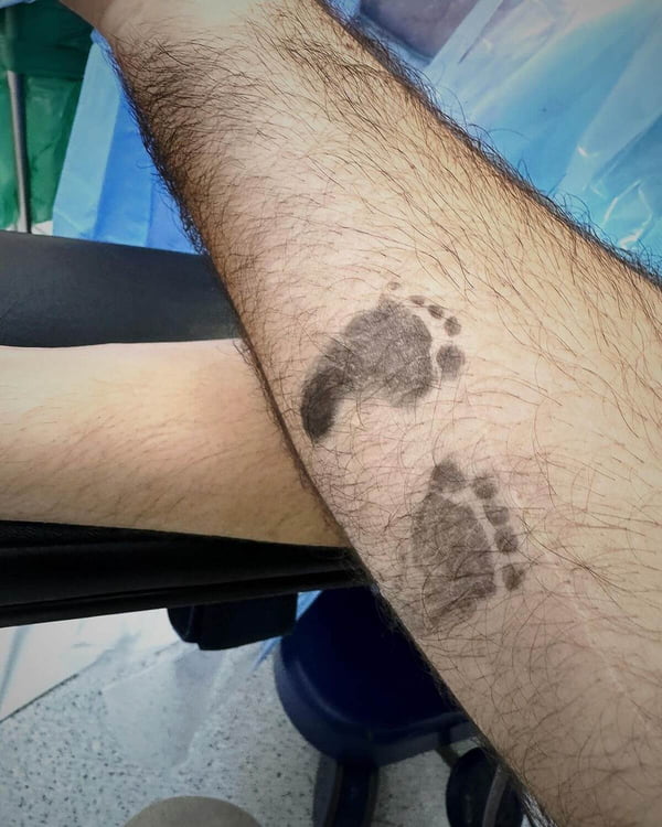 Braços de Nadja Haddad e do marido com a marca dos pés de um dos gêmeos - Metrópoles