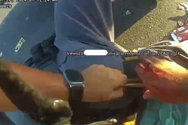 Mãos fazendo curativo em uma perna ferida - Metrópoles