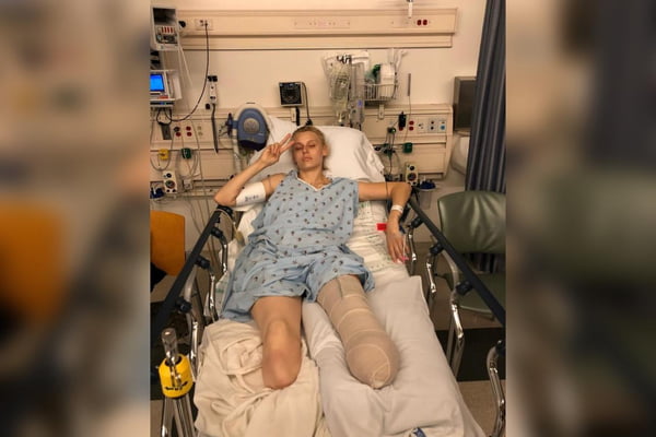Imagem mostra Lauren deitada na cama do hospital com as duas pernas amputadas - Metrópoles
