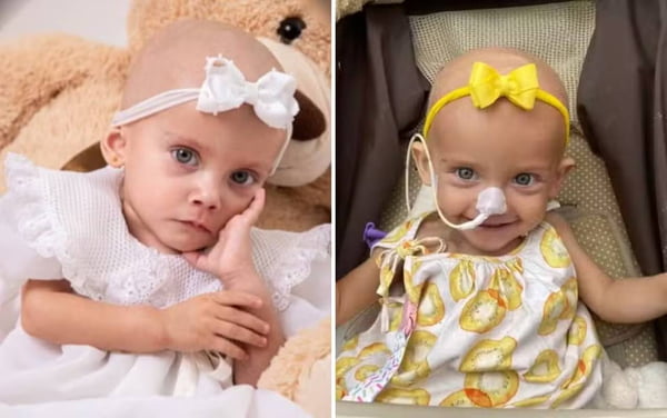 imagem colorida morre bebe que comoveu web tratamento cancer