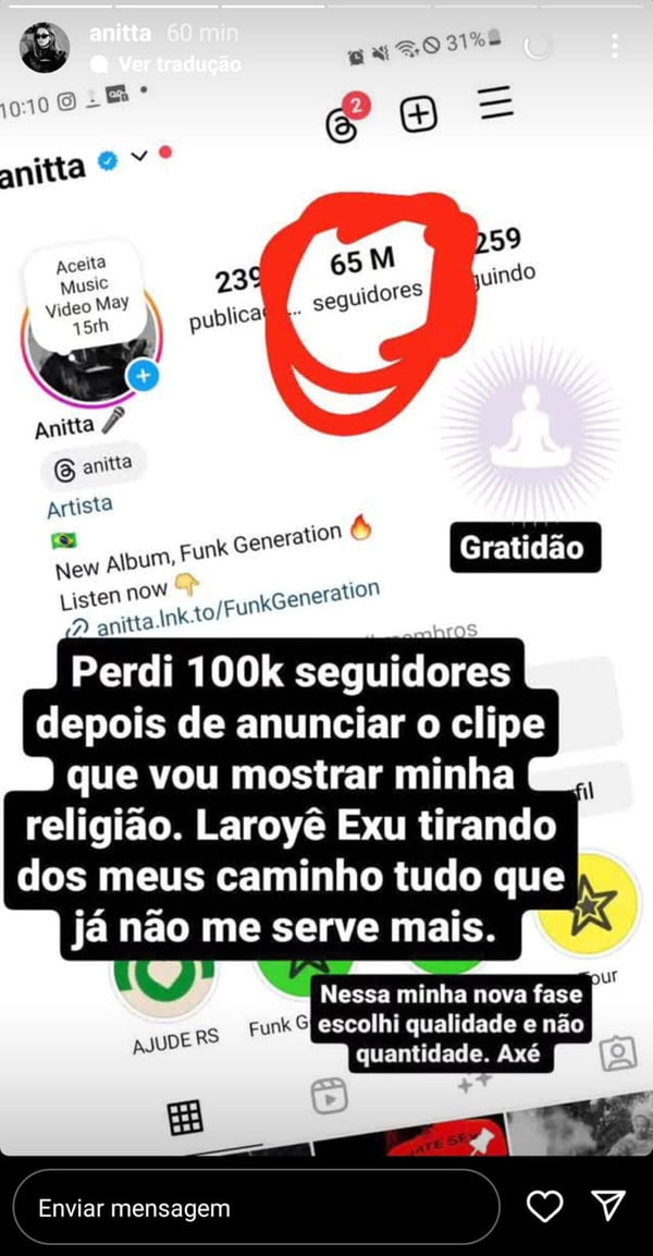 Print da postagem de Anitta sobre perda de seguidores - Metrópoles
