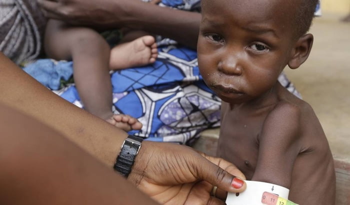 nigéria fome desnutrição