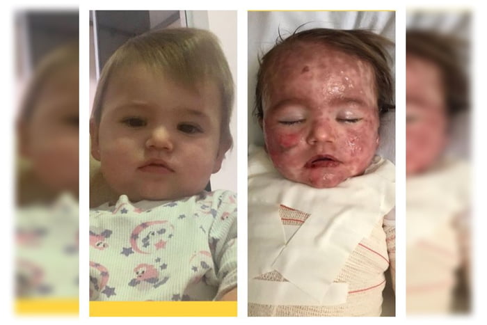 Bebê teve reação alérgica a medicamento e precisou ser internada. Família pede ajuda