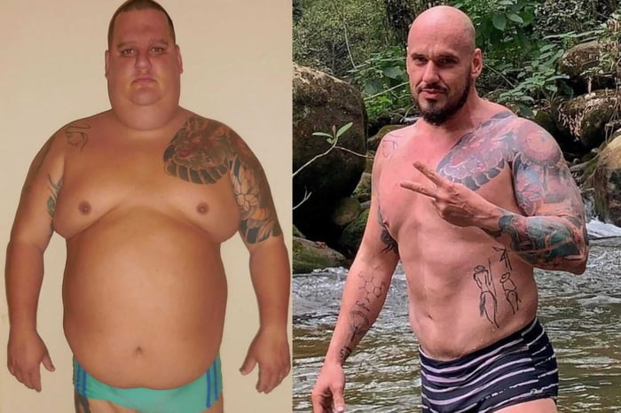 Felippe Ornellas fez cirurgia bariátrica e emagreceu mais de 90 quilos