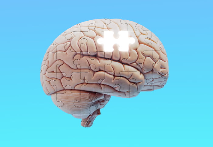 Ilustração de um quebra cabeça de cérebro- Metrópoles