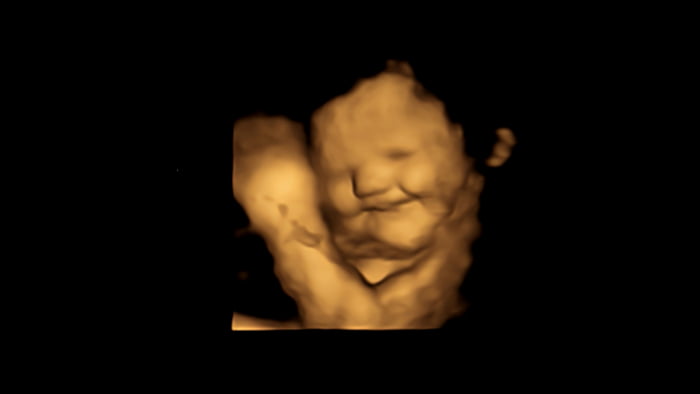 reação sorridente de bebê reagindo a sabor de cenoura no útero