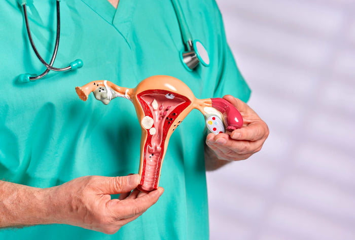 Imagem colorida de médico segurando escultura que imita um sistema reprodutivo feminino para falar sobre câncer - Metrópoles