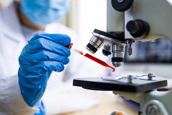 Técnico faz exame sangue analizando-o em laboratório para encontrar câncer