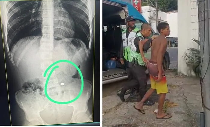 Segurança Presente prende jovem que furtou e engoliu cordão de ouro na Barra da Tijuca