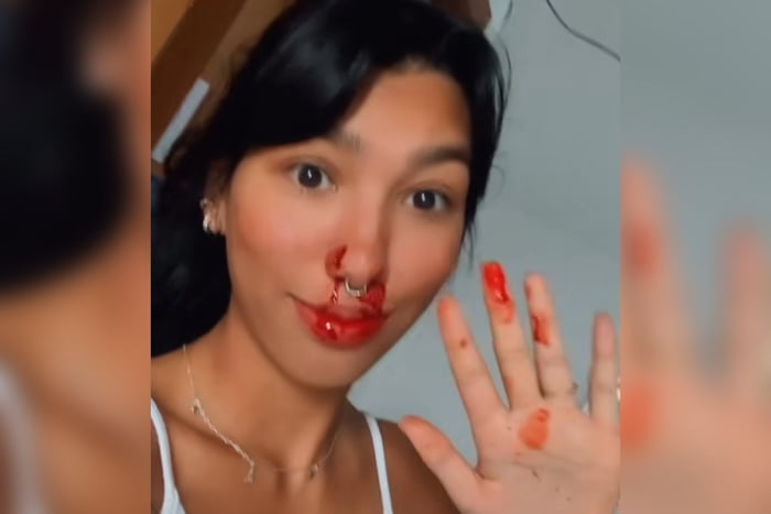 Imagem colorida de jovem com sangue no rosto - Metrópoles